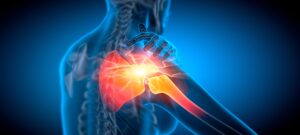 Ultraschalldiagnostik
